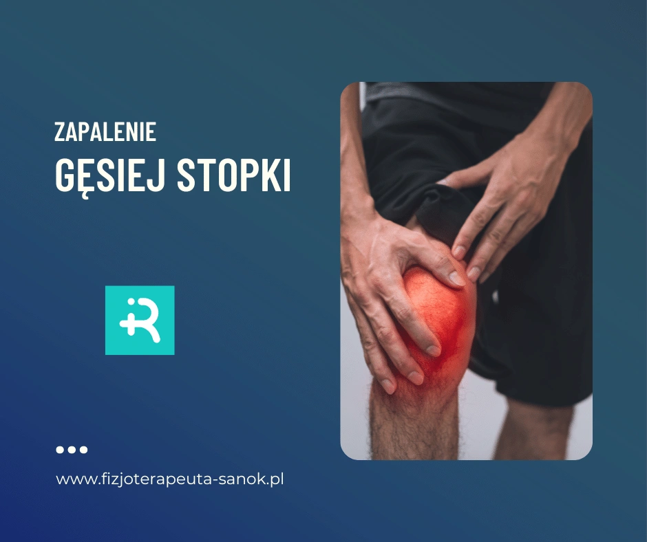Zapalenie gęsiej stopki, ból kolana, fizjoterapia.