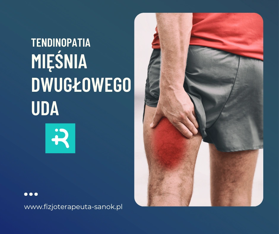 Ból uda, tendinopatia mięśnia dwugłowego, fizjoterapia.