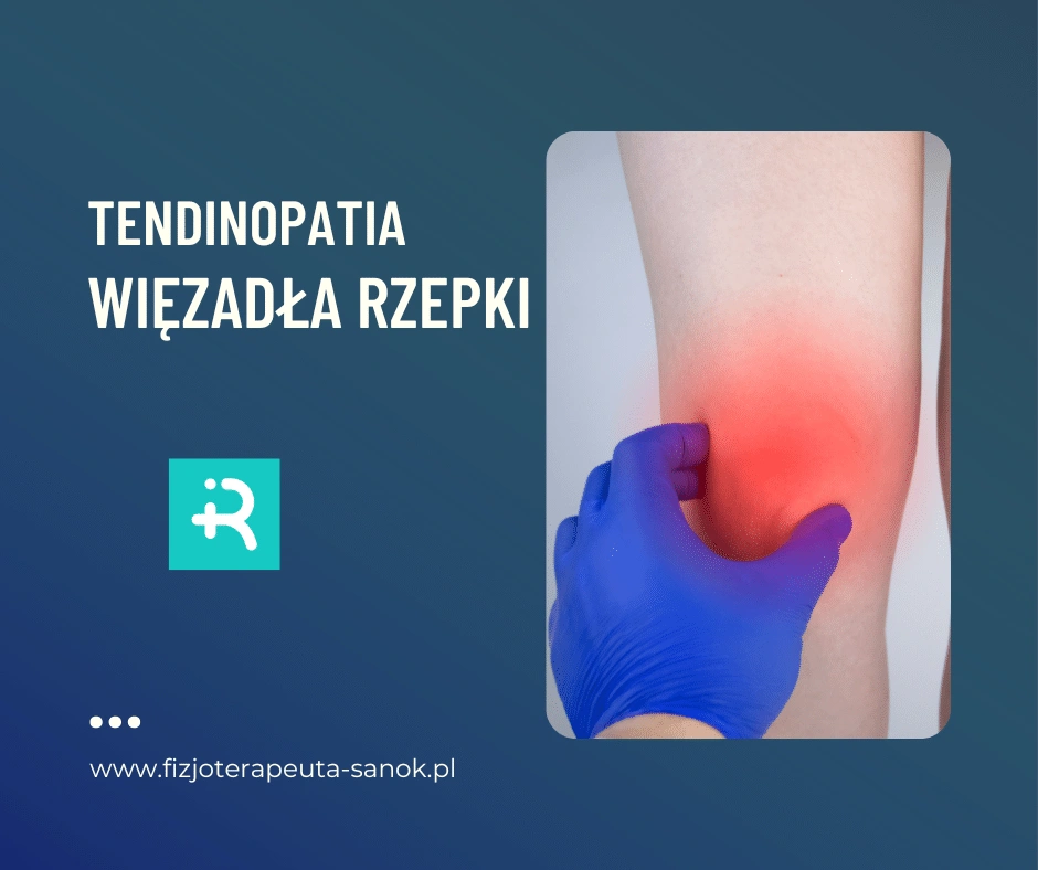 Tendinopatia więzadła rzepki, leczenie kolana, fizjoterapia.